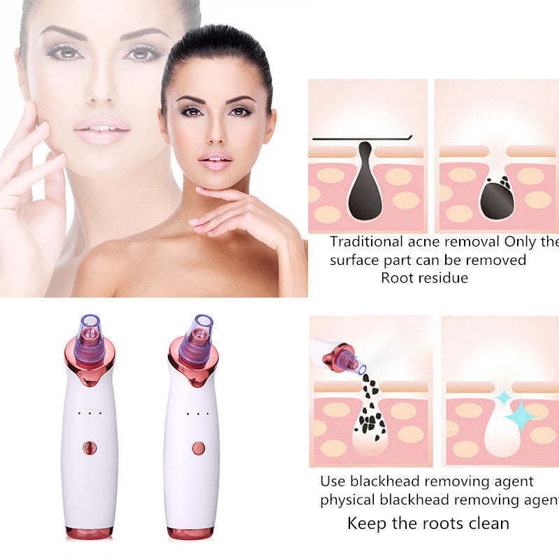 Blackhead Remover Acne Vacuum Suction Face Clean Black Head Pore Cleaning Beauty Skin Care Tool